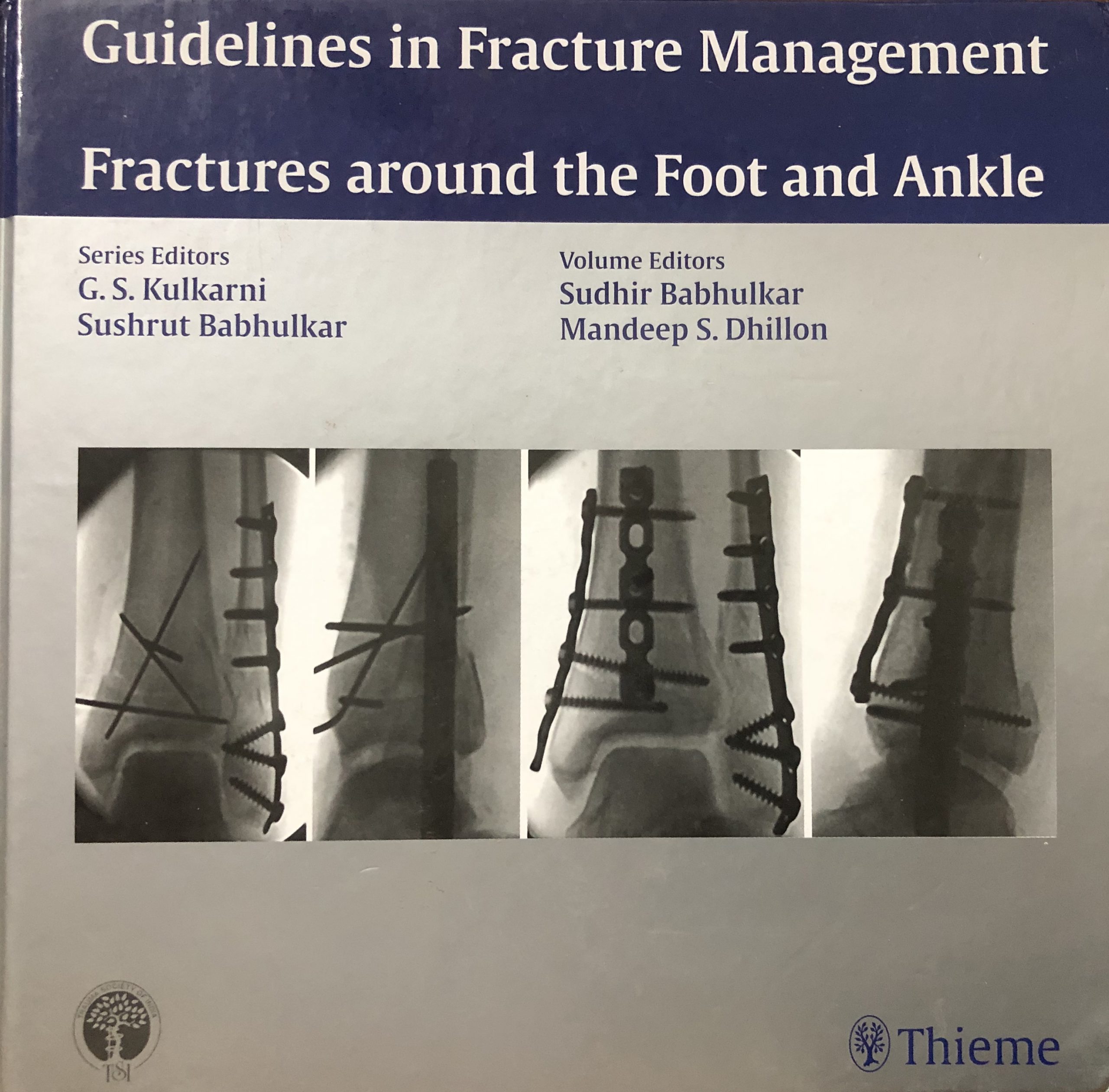 guidelines in fracture management